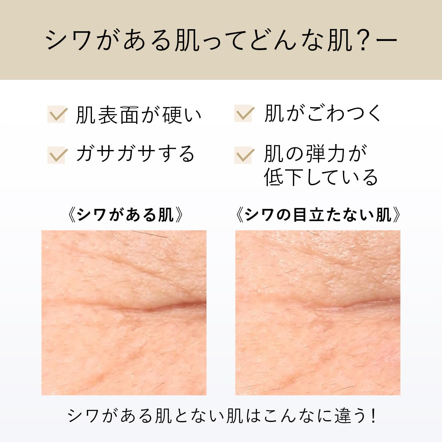 資生堂 ELIXIR 膠原彈潤 視黃醇抗皺精華乳 S 15g | 日本熱銷 No.1 | 撫平眼下細紋 法令紋 頸部保養 Japan E-Shop