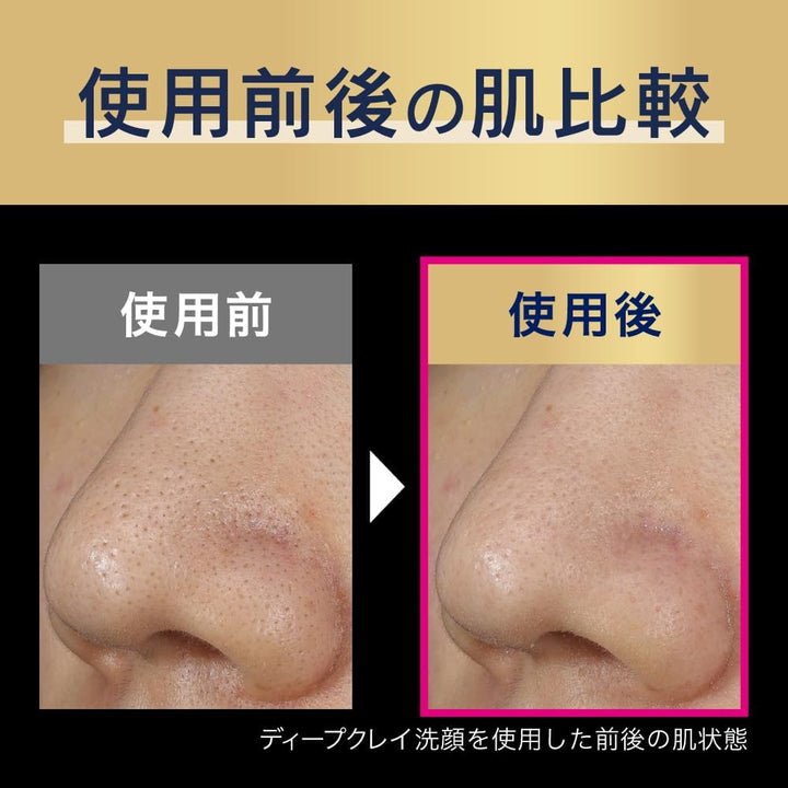 Biore 蜜妮 家中美體 深層毛孔泥洗顏 180g 獨家角栓崩壊技術 擊退黑頭粉刺 Japan E-Shop